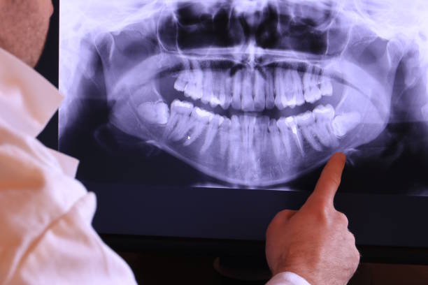Best Broken Tooth Emergency  in Mount Carroll, IL